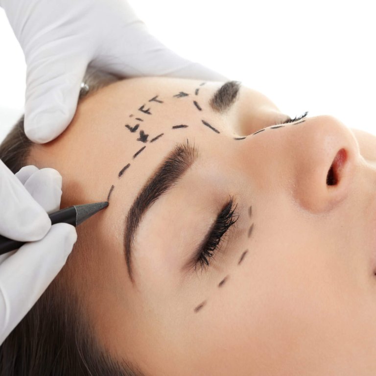 Plastic,Surgery,Concept.,Hands,In,Gloves,Marking,Women,Face